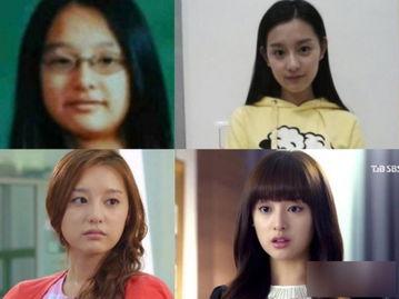 整容整坏香港明星,美丽代价与警示